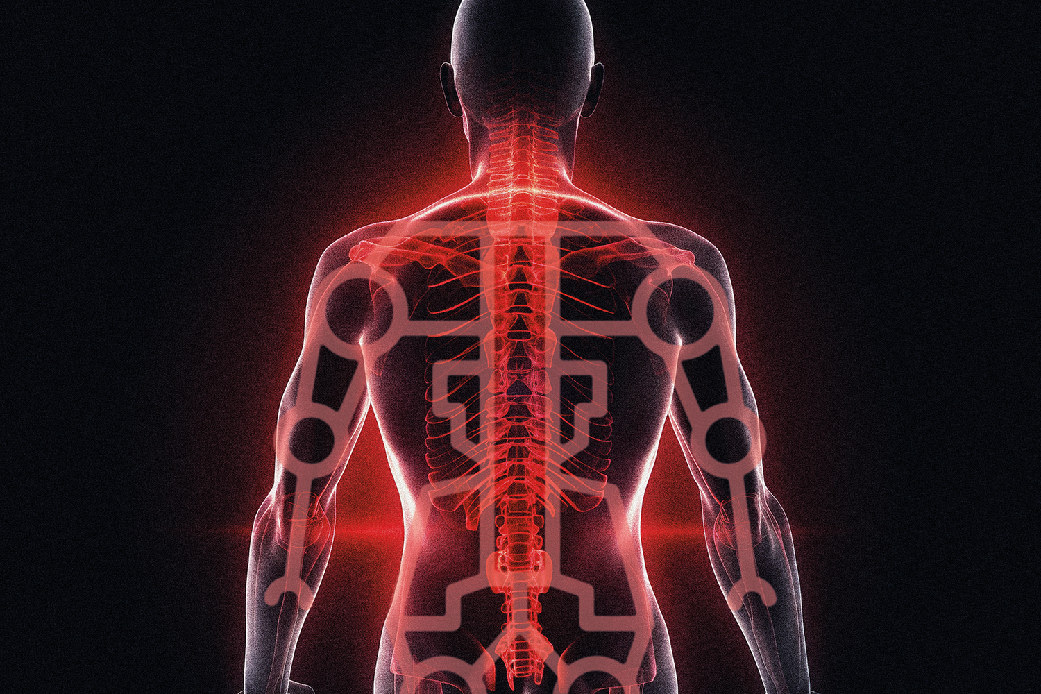 Musculoskeletal disorders